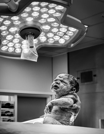 beleid protocol geboortefotografie ziekenhuis geboortezorg verloskunde